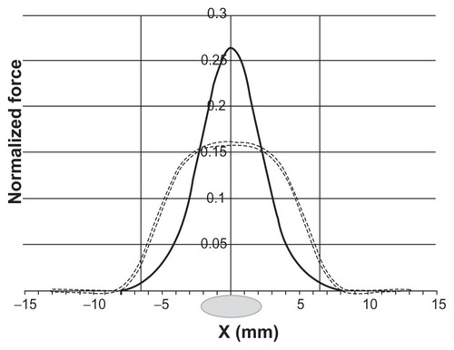 Figure 4 Scaled z-component of the magnetic force (normalized to χμ0VcMS2/a, where MS is the saturation magnetization of the magnet and a is the lateral half-size of the magnet) calculated as a function of the coordinate in the cerebrospinal fluid channel for a slab-shaped magnet (dashed) and one with a central step 4 × 7 × 2 mm (black).Note: The force was calculated for the plane 4.5 mm above the magnet’s surface. The vertical lines indicate the boundaries of the magnet, xb = ±6.5 mm (13 × 7 × 2 mm). The lesion site is shown as a grey ellipse at the origin of the coordinate system.