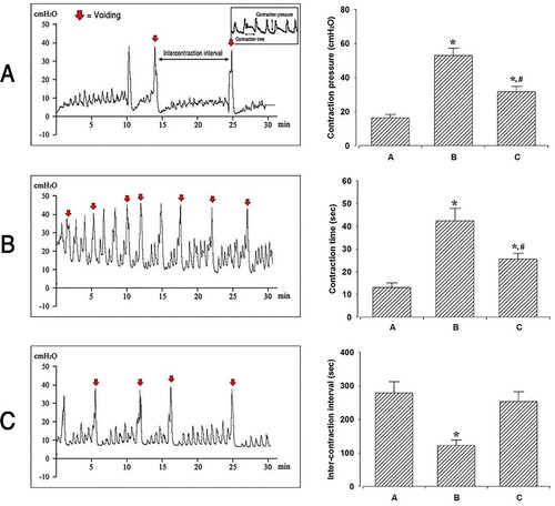 Figure 2. Effects of BoNT-A administration to the tibial nerve perineural space on bladder function through cystometry. Contraction pressure, contraction time, and inter-contraction interval amongst the three experimental groups: A: Control group; B: OAB group; C: Treatment group. *P < .05 compared to the control group. #P < .05 compared to the OAB-induced group.