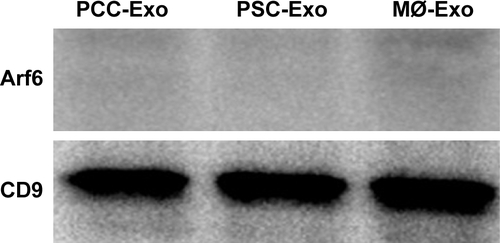 Figure S1 Immunoblot analyses of exosomes shed by PCCs, PSCs, and MØs demonstrate the purity of Exos.Notes: Equivalent amount of Exos shed by PCCs, PSCs, and MØs was lysed and resolved by SDS-PAGE. Immunoblotting revealed the presence of exosomal marker (CD9) but the absence of microvesicle marker (Arf6).Abbreviations: Exos, exosomes; MØs, macrophages; PCCs, pancreatic cancer cells; PSCs, pancreatic stellate cells.