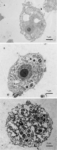 Fig. 4 Electron microscope image showing the intracellular localisation of V. cholerae in A. castellanii. A. A. castellanii trophozoite in the absence of bacteria. B. V. cholerae O160 localised in cytoplasmic vacuoles of A. castellanii trophozoite, 2 h after co-cultivation. C. V. cholerae O4 in cytoplasmic vacuoles of A. castellanii trophozoite, 4 h after co-cultivation.