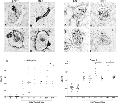 Figure 1. Representative sections of glomerular immunostaining for α-smooth muscle actin (A–D) and desmin (F–I) in IL12+/+ (A, F) and IL12–/– (B, G) control mice and IL12+/+ (C, H) and IL12–/– (D, I) HSV-treated mice. Graphs depict the score of glomerular expression of (E) α-smooth muscle actin and (J) desmin, and horizontal bars mean median (objective X40).