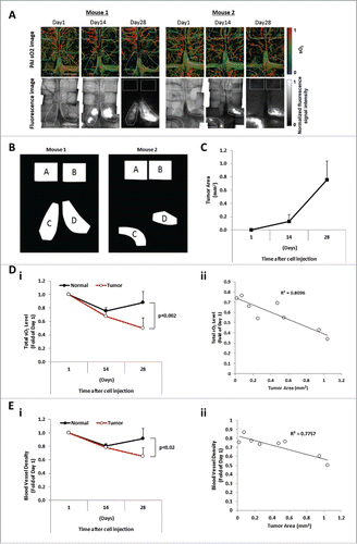 Figure 2. The sO2 level and blood vessel density are inversely correlated with the tumor burden. (A) Images of sO2 levels acquired by OR-PAM and the corresponding fluorescence microscopy images. The mouse brain was imaged at Day 1, Day 14, and Day 28 after intravenous injection of MM cells. Scale bars: 1 mm. (B) Designated regions of interest (ROI) of mouse 1 and mouse 2 used for analysis denoted as normal areas, regions A and B, and tumor areas, regions C and D. (C) Tumor progression evaluated as the tumor area (mm2) measured at Days 1, 14, and 28 post MM cell injection (mean ± SD), n = 4. (Di) Comparison of average relative total sO2 level between tumor and normal regions over the course of 4 weeks and normalized to Day 1 post MM injection (mean ± SD), n = 4. (Dii) Correlation between the oxygenation (total sO2) and the tumor area (mm2) with correlation coefficient R2 = 0.8096. (Ei) Comparison of average blood vessel density between tumor and normal regions over the course of 4 weeks and normalized to Day 1 post MM injection (mean ± SD), n = 4. (Eii) Correlation between the blood vessel density and the tumor area (mm2) shows a correlation coefficient R2 = 0.7757.