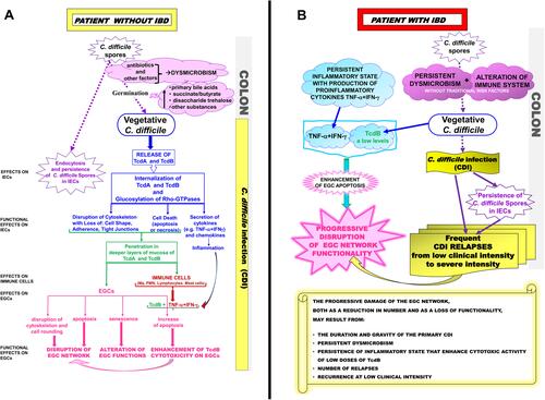 Figure 1 Schematic description of the events of CDI in patients without IBD and in patients with IBD. (A) Events of CDI in patient without IBD. (B) Events of CDI in patient with IBD.