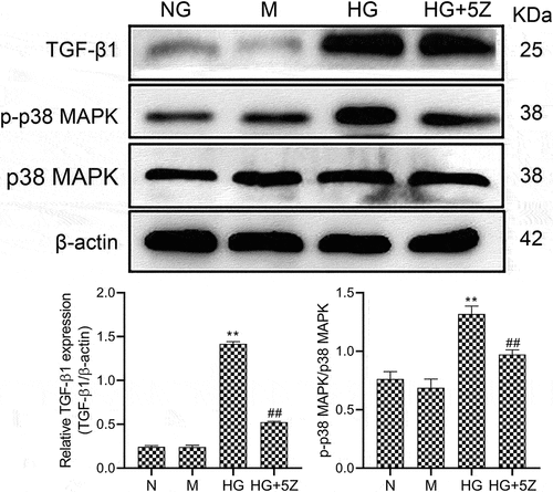 Figure 2. Effects of 5Z-7-oxozeaenol on HG-induced activation of related protein of TGF-β1/p38 MAPK pathway. All experiments were repeated 3 times. **P < 0.01 vs. NG group, ##P < 0.01 vs. HG group.