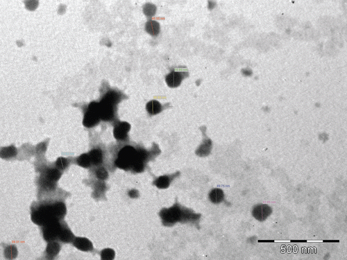 Figure 5.  Transmission electron microscopy of formulated nanoparticles (cGANP).