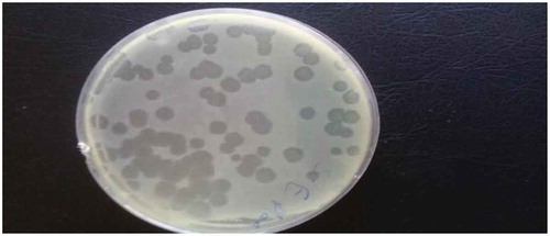 Figure 1. Plaque assay for bacteriophage enumeration.