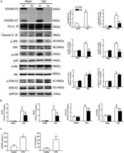 Figure 1. Changes of signaling pathways related to cardiomyocyte pyroptosis, hypertrophy and fibrosis. a, Western blot analysis for GSDMD, IL-18, JNK, p38, Akt, and ERK1/2 in all groups. b, Quantitative real-time PCR analysis of ANP, BNP, Col1a1, and Col3a1 gene expression in all groups. c, the serum levels of GSDMD and IL-18 in healthy volunteers or hypertensive patients. WT, wild-type mice; KO, cardiomyocyte-specific GSDMD-knockout mice; TAC, transverse aortic constriction; HTN, hypertension. †P < .05 versus the corresponding values of the sham or control group; *P < .05 versus the corresponding values of the WT group.