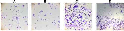 Figure 2 Vaginal cytology of rats showing phases of the estrus cycle with the cell type characterized as: (A) proestrus: consists of a predominance of nucleated epithelial cells; (B) estrus: cornified squamous epithelial cells; (C) metestrus: consists of mixed cells of leukocytes, nucleated cells (few), and cornified squamous epithelial cells; (D) diestrus: leukocytes are predominant.
