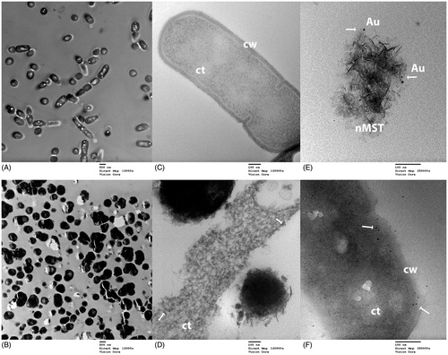 Figure 7. TEM images of L. casei (Lc) and nMST-Au(III) (A) and (C) untreated Lc images taken at magnification 12,000× and 120,000×, respectively. Bacterial cell wall (cw) and cytoplasm (ct) were marked. (B) and (D) Lc with nMST-Au(III) images taken at magnification 12,000× and 120,000×, respectively: arrows point to the nanoparticles (NPs) attached to bacterial cell wall (cw) and internalized into bacterial cytoplasm (ct) (E) arrows point to gold (Au) NPs in nMST compared in size, shape and density with (F) arrows pointing to NPs in Lc with nMST-Au(III). Image taken at magnification 250,000×.