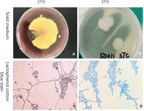 Figure 1 Morphological characteristics of T. marneffei. The fungi presented greenish-yellow colonies of rose-red pigment at 27°C PDA culture medium (A) and Gray-white cheese-like colony without pigment at 37°C SDA culture medium (B). Stained with lactophenol cotton blue, the fungi showed brush-like structure at 27°C (C), and oval yeast-like cells at 37°C (D).
