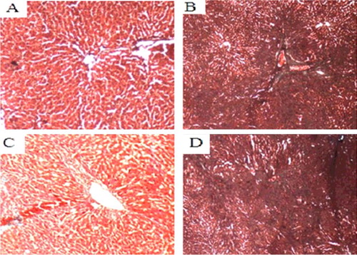 Figure 9. Liver tissues of each SD rat group (collagen Masson staining, 200×). Normal control group (A); model group (B); COX-2 shRNA-1 group (C); empty vector group (D).