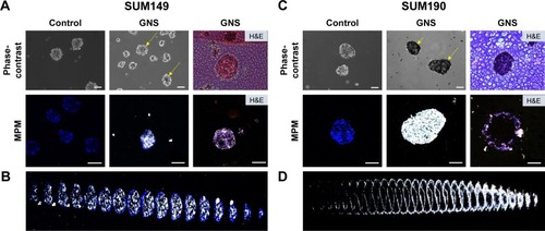 Figure 5 GNS are endocytosed by SUM149 (A, B) and SUM190 (C, D) tumor emboli, after which they penetrate into the tumor embolic core. Tumor emboli shown here are imaged after 96 hours of embolic maturation. The control groups represent cells that are free of nanoparticles. For GNS-labeled emboli, nanoparticles were added after 96 hours of embolic maturation. Following 24 hours of GNS incubation, samples were stained with Hoechst 3342 and imaged with MPM. The black portions, as shown by yellow arrows, represent GNS as observed by phase-contrast microscopy. GNS as observed by MPM is shown by white luminescence. H&E staining displays the cross-sectional area of the emboli, and MPM imaging of the cross-section further demonstrates the depth of GNS penetrance into the tumor embolic core (scale bars =100 μm). (B, D) 2D projections of the GNS-labeled tumor emboli depicted in A and C. Shown here are the individual Z slices of the stacked composite image. This projection demonstrates the depth of GNS penetrance into the tumor emboli.Abbreviations: GNS, gold nanostars; MPM, multiphoton microscopy; H&E, hematoxylin and eosin.