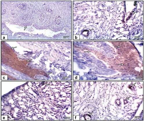 Figure 9. Photomicrographs of formalin-fixed rat uterine immunohistochemical stain with caspase-3, (a) negative control, (b) PVP-capped AuNRs positive control, (c and d) DMBA carcinogenesis and (e and f) DMBA carcinogenesis treated with PVP-capped AuNRs. Note that increased immunostaining of caspase-3 in DMBA carcinogenesis and improved in PVP-capped AuNRs-treated studied groups. The arrowheads show the degree of immunoreactivity.