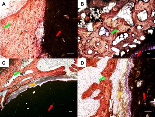 Figure 8 Histological morphologies after implantation at 8 weeks. (A) The 1:1 P/L ratio of CPC–FG; (B) 3:1 P/L ratio of CPC–FG; (C) 5:1 P/L ratio of CPC–FG; (D) pure CPC.