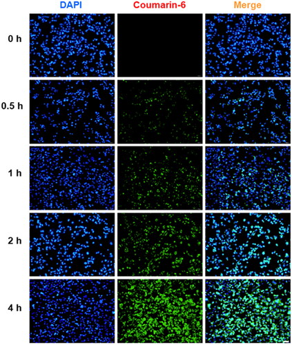 Figure 3. Representative fluorescence images of in vitro cellular uptake of Coumarin-6 labeled TPGS-PBTE NPs in SCC-7 cells at different time intervals.