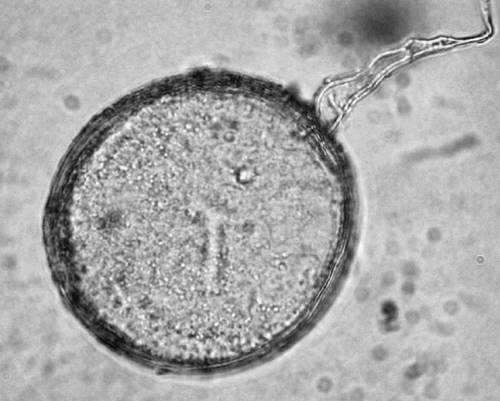 Fig. 6. Intact spore of Glomus albidum. The diameter of different spores was 89–149 μm.