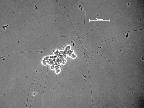 Figure 3. Microscopic phase contrast picture of floc and filamentous bacteria, during 25°C cultivation.