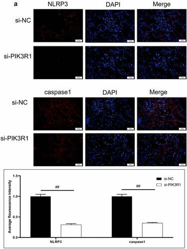 Figure 6. Regulatory effects on CRF genes and proteins by interfering PIK3R1. A, Expression of NLRP3 and caspase1 was detected by immunofluorescence. B, Expression of AQP1 and AQP2 was detected by immunofluorescence. C-D, Expression of p-PI3K, p-AKT, NLRP3, caspase1, AQP1, and AQP2 was detected by western blot. E, Grayscale statistical results by western blot. #, p < 0.05. ##, p < 0.01. Scale bar: 50 μm