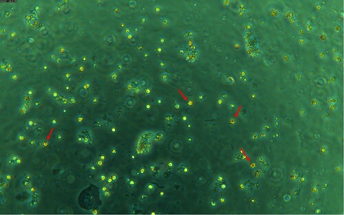 Figure 5. Microscopic analysis of a fluorochrome-labelled colostrum sample using a Leica DMi8 fluorescence microscope (Leica, Germany). Measurement parameters: Camera DMC6200-2000000379, digitalization: 8 bit, composite colour capture mode, objective: HC PL FLUOROTAR L 20x / 0.4 DRY, exposure time: 1.711 ms. ↑ (red arrow) – CD4+CD8+ (DP – double-positive) colostrum cells.