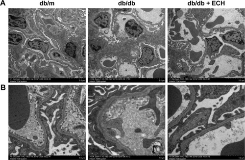 Figure 4 Effect of ECH on renal ultrastructural pathology in db/db mice.