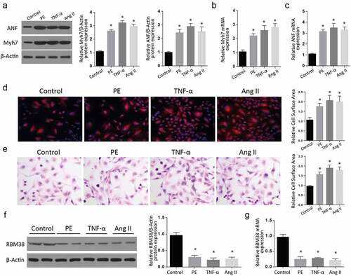 Figure 1. RBM38 is downregulated in in-vitro models of myocardial hypertrophy