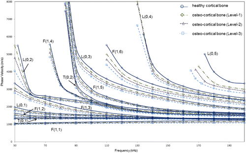 Figure 6. Phase velocity dispersion curves for suitable modes from SAFE analysis for varying osteoporosis levels (Levels 1, 2, and 3) of model 3 (healthy cortex filled with marrow and coated with soft tissue).