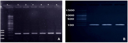 Figure 1 (A) Amplified PCR products of nuc gene at (270 bp). Lane 1: 100 bp ladder, Lanes 2–4: positive to Staphylococcus aureus; (B) Amplified PCR products of mecA gene at (147 bp). Lane (M) 100 bp ladder, Lanes 1–6: positive to mecA gene.
