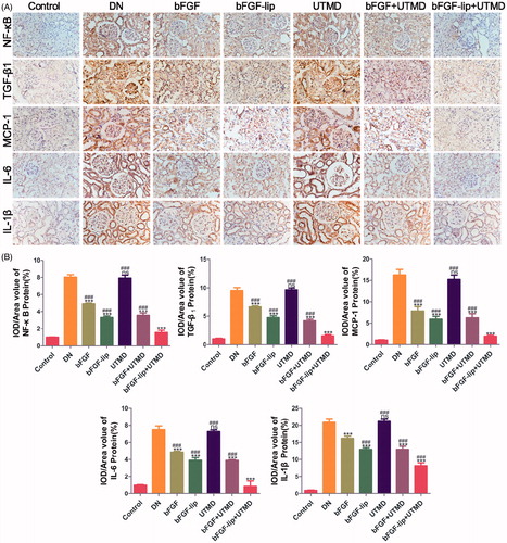 Figure 4. Effects of bFGF-lip + UTMD on NF-kb, TGF-β1, MCP-1, IL-6 and IL-1β release. (A) Immunohistochemistrical staining of NF-κB, TGF-β1, MCP-1, IL-6 and IL-1β; (B) quantitative analyses of renal NF-κB, TGF-β1, MCP-1, IL-6 and IL-1β immunohistochemistry, N = 6 per group. Data are expressed as the mean ± SD. *p < .05, **p < .01 and ***p < .001 versus the DN group, #p < .05, ##p < .01 and ###p < .001 versus the bFGF-lip + UTMD group.
