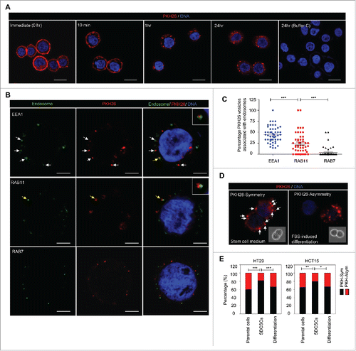 Figure 1. The symmetrical distribution of PKH26-labeled subcellular compartments occurs in colorectal cancer stem cells. (A) The representative images for PKH26 dye labeling in HT29 cells at the indicated time points. PKH26 dye, red; DNA, blue. Scale bar = 20 μm. (B) The immunofluorescent pictures for showing the association of PKH26-labeled vesicles and endosome markers. PKH26 dye, red; endosome markers (EEA1, RAB11 and RAB7), green; DNA, blue. Scale bar = 5 μm. Arrows indicate the association or colocolization. Insert: magnified vesicle association indicated by yellow arrows. (C) The quantification results of association of PKH26-vesicles and indicated endosome markers in HT29 parental cells. Data represent mean ± SEM ***, p < 0.001 (Student's t test). (D) Representative images of symmetric or asymmetric segregation of PKH26-labeled vesicles in HT29 SDCSCs cultured under stem cell medium or in FBS-induced differentiation, respectively. PKH26 dye, red; DNA, blue. insert: phase pictures for showing paired-cells. (E) The percentage of the asymmetry/symmetry of PKH26-labeled vesicles in parental cells, SDCSCs and serum-differentiated SDCSCs (differentiation) in HT29 and HCT15 cells. n (total counted cells over 2 independent experiments) = 142, 223, 83, 144, 196, and 54 for HT29 parental cells, HT29 SDCSCs, Differentiation (HT29 SDCSCs), HCT15 parental cells, HCT15 SDCSCs, and Differentiation (HCT15 SDCSCs), respectively. PKH-Sym, symmetric segregation of PKH26-labeled vesicles; PKH-Asym, asymmetric segregation of PKH26-labeled vesicles. The p-value is estimated by χ2 test. *, p < 0.05; **, p < 0.01 ***, p < 0.001.