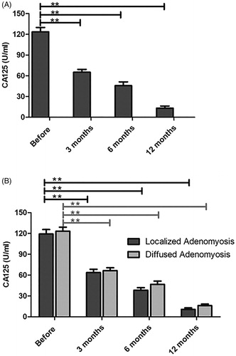 Figure 5. The serum CA-125 value was compared before and after treatment with HIFU. (A) The serum CA-125 level was significantly reduced with the combined treatment and within the normal range at 12 months after HIFU. (B) Localized and diffused adenomyosis revealed an obvious decline in CA-125 levels and better efficacy was observed for localized lesions.