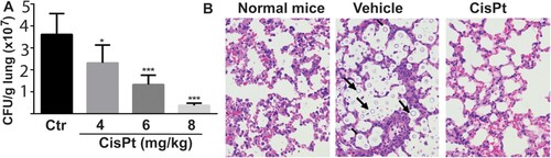 Figure 1. Efficacy of cisplatin in a mouse model. (A) Fungal loads of Cryptococus neoformans cells in colony forming unit (CFU) were enumerated in the lungs of mice after treatment with the vehicle control (saline) and cisplatin for 4 days. Six mice per group were used. Data are expressed as mean+SD; the experiments were performed three times. (*) p<.05, (**) p<.01, and (***) p<0.001. (B) Light micrographs of Haemotoxylin and Eosin staining sections of the lungs after treatment with cisplatin. The cryptococci are indicated by arrows and are absent in the 8 mg/kg cisplatin treatment.