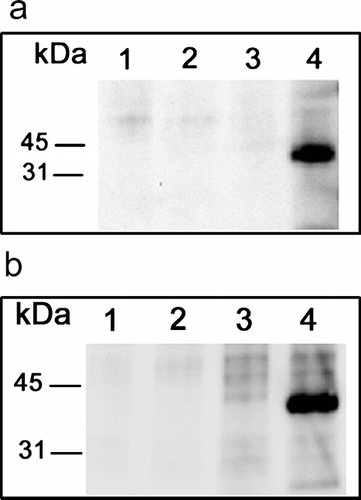 Figure 4 Western blotting of JAM-C in human fibroblasts. Dermal (A) and lung (B) fibroblasts were surface biotinylated, lysed in 1% TX-100 buffer, and subjected to immunoprecipitation. Primary rabbit polyclonal antibodies were: preimmune (lane 1), JAM-A (lane 2), JAM-B (lane 3), and JAM-C (lane 4). JAM-antibody complexes were precipitated with protein-A sepharose, subjected to SDS electrophoresis, transferred to Immobilon-P and biotinylated protein was detected using streptavidin-HRP coupled with enhanced chemiluminescence (ECL). Digital images were directly captured and analyzed using a Biorad ChemiDoc EQ System and QuantityOne software.