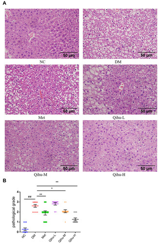 Figure 4 The effect of Met and Qihu on the pathological changes of liver in db/db mice. (A) The effect of Met and Qihu on the pathological changes of liver in db/db mice. The liver was excised from db/db mice and part of the tissues was fixed with 4% paraformaldehyde, and then embedded in paraffin and stained with hematoxylin and eosin (magnification: ×400). (B) The result of pathological score in all the groups of mice. All data were expressed as mean ± SD (n = 7–8). ## p < 0.01 vs NC, *p < 0.05 or **p < 0.01 vs DM.