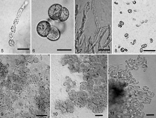 Figs 5–11. Light photomicrographs of algae isolated from crustose lichens of the family Verrucariaceae. 5. Filamentous growth in young culture of Heterococcus sp. isolated from Verrucaria funckii and cultured on 1.5% BBM-agar (BM H. Thüs W1174). 6. Cell aggregates of Heterococcus sp. isolated from V. funckii and cultured in liquid BBM medium (BM H. Thüs W1174). 7. Dilabifilum sp. isolated from V. aquatilis (BM H. Thüs W1125). 8. Chloroidium sp. isolated from V. praetermissa (BM H. Thüs W1198). 9. Elliptochloris bilobata isolated from V. sublobulata (BM H. Thüs W0975). 10. Diplosphaera sp. isolated from V. elaeina (BM H. Thüs W1269). 11. Stichococcus cf. mirabilis isolated from Staurothele clopima (BM H. Thüs W1118). Scale bars: 10 µm.