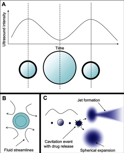 Figure 5 Microbubble interactions with ultrasound. (A) The microbubble diameter changes when exposed to the pressure waves of ultrasound. During the compression portion of the wave the microbubble diameter shrinks, while during rarefaction the microbubble expands. The diameter can change by a factor of eight between these two states. (B) Pressure differences are created around the microbubble as it undergoes vibrational size changes, driving the surrounding fluid to flow around it in various patterns. This microstreaming can be used to disrupt nearby membranes. (C) When resonance is achieved between the microbubble oscillations and the driving ultrasound frequency, the microbubble can undergo an adiabatic implosion.