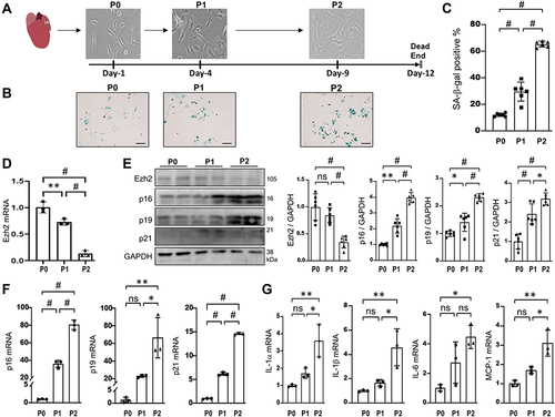 Figure 3 Ezh2 is down-regulated in a RS model of AFs. (A) Schematic diagram of our RS model of AFs isolated from young mice and classified as P0, P1 and P2. bar=20μm. P0, P1 and P2 cells were harvested for multiple analyses in B~G. (B and C) Representative images of SA-β-gal staining and their quantitative analyses (n=6 mice in each group). (D) Transcriptions of Ezh2 was assessed by qRT-PCR (n=3 in each group). (E) Representative WB images of Ezh2 and CDKIs markers as indicated, as well as their densitometry analyses (n=6). (F and G) Transcriptions of CDKIs (F) and SASP genes (IL-1α, IL-1β, IL-6, MCP-1; (G) were evaluated by qRT-PCR (n=3 in each group). Data are presented as mean ± SD. *p<0.05, **p<0.01, #p<0.001.