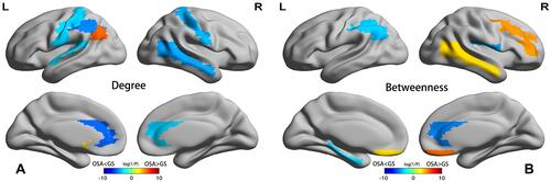 Figure 4 Differences between the OSAHS and GS groups in regional network metrics (uncorrected). Regions that showed significant differences between OSAHS and GS in nodal degree (A) and nodal betweenness centrality (B) for networks thresholded at the minimum density. The color bar indicates log(1/P). Warm colors denote regions with significantly higher nodal degree or betweenness in the OSAHS group compared with the GS group, while cool colors denote regions with significantly higher nodal degree or betweenness in the GS group compared to the OSAHS group.