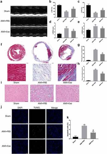 Figure 3. HUVECs-derived exosomes improved cardiac function and myocardial pathological changes in AMI mice. (a) Representative M-mode echocardiographs in short axis using transthoracic echocardiography. (b-e) Cardiac function-related indicators, including LVEF, LVFS, LVESD, and LVEDD (n = 6 per group). (f-h) Quantification of fibrosis area and scar circumference in left ventricular after Masson’s trichrome staining (scale bar = 200 µm or 50 µm) (n = 6 per group). (i) Pathological changes in the cardiac tissues in HE staining (scale bar = 50 µm). (j-k) Cardiomyocyte apoptosis in the mice’s infarcted hearts was tested by TUNEL staining (scale bar = 50 µm) (n = 6 per group). Statistical data were described as mean ± SD, ANOVA was used followed by LSD post hoc least significant difference test; *P < 0.05, **P < 0.01 vs. Sham group; ##P < 0.01 vs. AMI + PBS group. Abbreviations: AMI, acute myocardial infarction; PBS, phosphate-buffered saline; Exo, exosome; LVEF, left ventricular ejection fraction; LVFS, left ventricular fractional shortening; LVESD, left ventricular end-systolic diameter; LVEDD, left ventricular end-diastolic diameter; DAPI, 4’,6-diamidino-2-phenylindole; and TUNEL, terminal deoxynucleotidyl transferase (TdT)-mediated dUTP nick-end labeling.