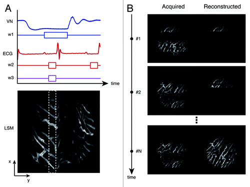 Figure 3. Top left, a timing diagram for image acquisition. VN, lung airway pressure trace; W1, the gating window centered at the end of the expiration phase; ECG, electro-cardiogram trace recording; W2, the gating window at the end of the diastolic phase; W3, the temporally stabilized window. Bottom left, acquired images exhibit motion artifacts due to heart beat and respiration. Within the raw image, an undistorted area was observed at the point where end-diastole coincided with end-expiration; data were collected from the area (patch) bound by the white dashed box within the distortion-free temporally stabilized window (W3). Right, by collecting sequential images through retrospective gating or prospective triggering (images on the left), images of undistorted areas (right) could be obtained and reconstructed to generate a final artifact-free image (bottom right image).