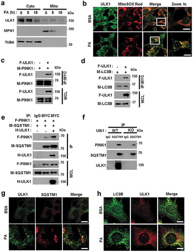 Figure 10. ULK1 enhances the interaction between SQSTM1 and PINK1. (a) Mitochondrial fractionation analysis of Hepa1c1c7 cells after treatment with PA (500 μM) for the indicated times; samples were subjected to immunoblot analysis using antibodies specific for ULK1, MFN1, and TUBA (loading control). (b) Confocal microscopy analysis of MitoSOX Red and ULK1 staining in Hepa1c1c7 cells after treatment with PA (500 μM) for 18 h. Nuclei were also stained with DAPI, and representative single optical sections and merge images are shown. Scale bars: 10 μm. (c) Lysates of HEK293 cells transfected with MYC-PINK1 and FLAG-ULK1 were subjected to immunoprecipitation using MYC antibodies, and the resulting immunoprecipitation (IPs), as well as the whole cell lysates (WCLs), were subjected to immunoblot analysis with antibodies specific for the indicated proteins. (d) Lysates of HEK293 cells transfected with F-ULK1 and M-LC3B was subjected to IPs with MYC antibodies, and the resulting IPs and WCLs were subjected to immunoblot analysis using antibodies specific for the indicated proteins. (e) Lysates from HEK293 cells transfected with F-PINK, M-SQSTM1, and H-ULK1 were subjected to immunoprecipitation using MYC antibodies, and the resulting IPs and WCLs were subjected to immunoblot analysis with antibodies specific for the indicated proteins. (f) Lysates from Ulk1 WT or ulk1 KO MEF cells were subjected to immunoprecipitation with antibodies for SQSTM1, and the resulting IPs and WCLs were subjected to immunoblot analysis using antibodies specific for the indicated proteins. (g) Confocal microscopy analysis of SQSTM1 and ULK1 colocalization. Scale bar: 5 μm. (h) Confocal microscopy analysis of colocalization of LC3B and ULK1 in Hepa1c1c7 cells co-transfected with vectors encoding M-LC3B and H-ULK1. Scale bar: 5 μm. Data are presented as the mean ± SD from three independent experiments.