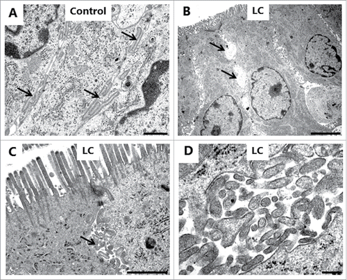 Figure 9. LC action on the enterocyte lateral cell membranes. Electron micrographs of the lateral cell membranes from mucosal explants cultured for 1 h in the absence (A) or presence of 2 mM LC (B-D). A: Highly meandering lateral cell membranes between adjacent cells (arrows). B: Formation of vacuoles (arrows) along the intercellular space. C: Formation of vesicle-like structures filled with cytoplasmic material (arrows). D: Lateral vesicles shown in higher magnification. The images shown of each situation are representative of at least 5 images. Bars: 1 µm (A, C); 5 µm (B); 0.2 µm (D).
