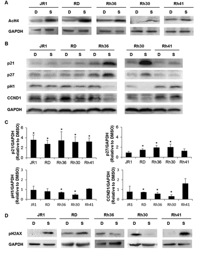 Figure 3. SAHA induces cell cycle inhibitors and a DNA damage response in RMS cells. Western blot analysis of (A) acetylated histone H4 (AcH4), (B) the indicated cell cycle proteins at 48 hours after treatment with vehicle DMSO control (D) or 1 μM SAHA (S) in the indicated cell lines. (C) Histograms represent the quantification of the western blot bands in the indicated cell lines compared to GAPDH and relative to DMSO from at least 3 independent experiments. Bars represent standard deviation. Asterisks denote a statistically significant difference (p-value < 0.05). (D) Western blot analysis of the DNA damage response protein phospho-H2AX at 48 hours after treatment with vehicle DMSO control (D) or 1 μM SAHA (S) in the indicated cell lines. GAPDH serves as a loading control for all western blots.