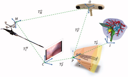 Figure 4. AR transformation diagram which combines hand-eye calibration and image-to-patient registration.