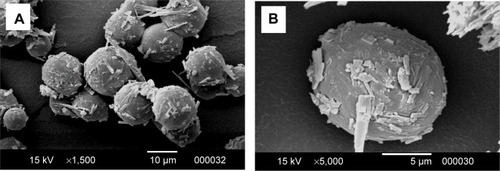 Figure 1 SEM images of OFX microspheres formulation at different magnifications.