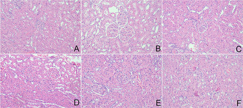 Figure 3 Effects of APS on the pathological lesions in the kidneys of DN rats (×200). (A) Control. (B) Model. (C) Low. (D) Medium. (E) High. (F) Metformin.