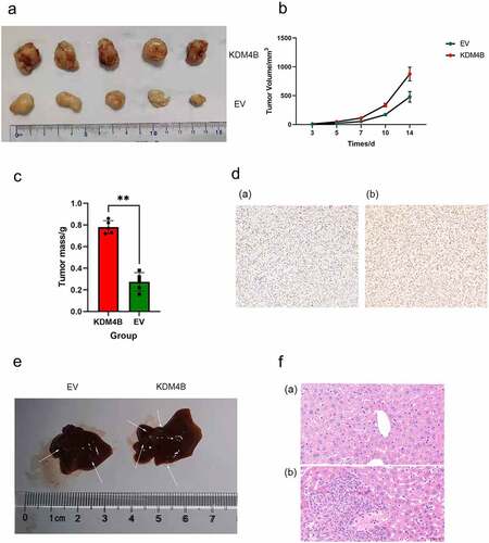 Figure 4. KDM4B promotes tumour growth and metastasis in vivo. (a) Tumors grown in xenograft mice from KDM4B overexpressed and control 786-O cell lines at 28 days. (b) Tumor growth curves of EV and KDM4B overexpressed groups. (c) Weight of KDM4B overexpressing tumours and control tumours of xenograft mice. (d) Representative IHC of xenograft tumours of (a) Control group and (b) KDM4B overexpressing group. (e) Livers from xenograft mice. Visible metastases on the liver are marked with arrows. (f) H&E staining of the livers. (a) Normal liver and (b) liver with metastasis. (EV: empty vector).