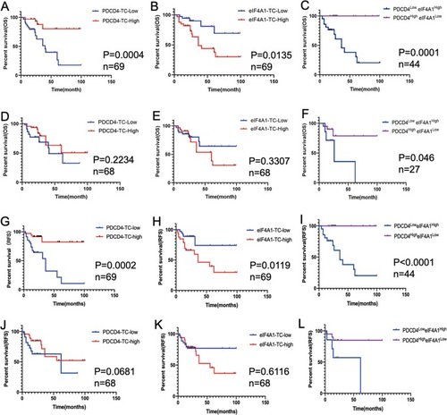 Figure 4 Kaplan–Meier survival curves for overall survival time of OSCC patients according to the expression of PDCD4 and eIF4A1 in TCs in tumor center (A–C) and invasive front (D–F). Relapse-free survival time of OSCC patients according to the expression of PDCD4 and eIF4A1 in TCs in tumor center (G-I) and invasive front (J-L).