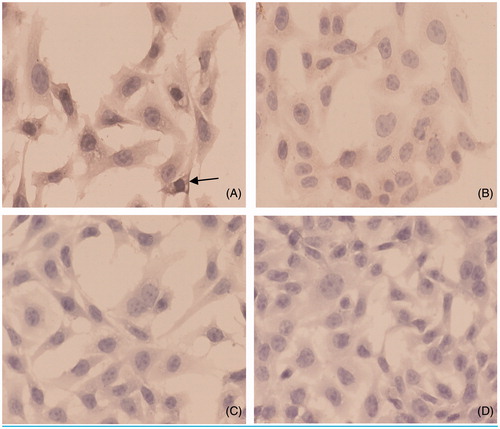 Figure 1. Immunohistochemical analysis of TLR2 protein. (A) ACS group; (B) SAP group; (C) control group; (D) anti-TLR2 group. Original magnification, ×400. Abbreviations: ACS, acute coronary syndrome; SAP, stable angina pectoris; → refer to the location of TLR2.