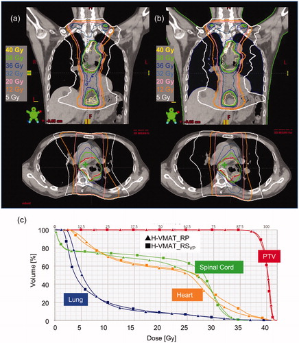 Figure 1. Dose distribution and dose volume histogram (DVH) for H-VMAT with RayStation (H-VMAT_RSVP) (a) and RapidPlan (H-VMAT_RPRS) (b) in representative validation plans. In the dose distribution, upper is coronal and bottom is axial. The coloured curves represent different isodose curves. Yellow, green, pink, orange, and white represent the isodose curves of 40, 38, 20, 10, and 5 Gy, respectively. Adding, red curves represent the planning target volume (PTV). In the DVH (c), curves with square are H-VMAT_RSVP and with triangles H-VMAT_RPRS. The coloured curves represent different OARs. Red, green, orange, and blue represent PTV, spinal cord, heart, and lung, respectively.