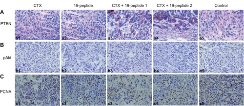 Figure 4 Immunohistochemistry revealing different proteins in intervention groups relative to controls. Micrographs of cells after immunohistochemistry showing that PTEN, pAKt, and proliferating cells were produced by the different groups. After treatment with cyclophosphamide and/or Chalone 19-peptide, PTEN was increased. pAkt and PCNA were decreased and necrosis was observed (×460). (A) Immunohistochemistry testing of PTEN. (a1) Cyclophosphamide group, (a2) Chalone 19-peptide group, (a3) Cyclophosphamide 100 mg/kg and Chalone 19-peptide combined treatment, (a4) Cyclophosphamide 50 mg/kg and Chalone 19-peptide combined treatment group, and (a5) control group. (B) Immunohistochemistry testing of pAkt. (b1) Cyclophosphamide group, (b2) Chalone 19-peptide group, (b3) Cyclophosphamide 100 mg/kg and Chalone 19-peptide combined treatment group, (b4) Cyclophosphamide 50 mg/kg and Chalone 19-peptide combined treatment group, and (b5) control group. (C) Immunohistochemistry testing of PCNA. (c1) Cyclophosphamide group, (c2) Chalone 19-peptide group, (c3) Cyclophosphamide 100 mg/kg and Chalone 19-peptide combined treatment group, (c4) Cyclophosphamide 50 mg/kg and Chalone 19-peptide combined treatment group, and (c5) control group.